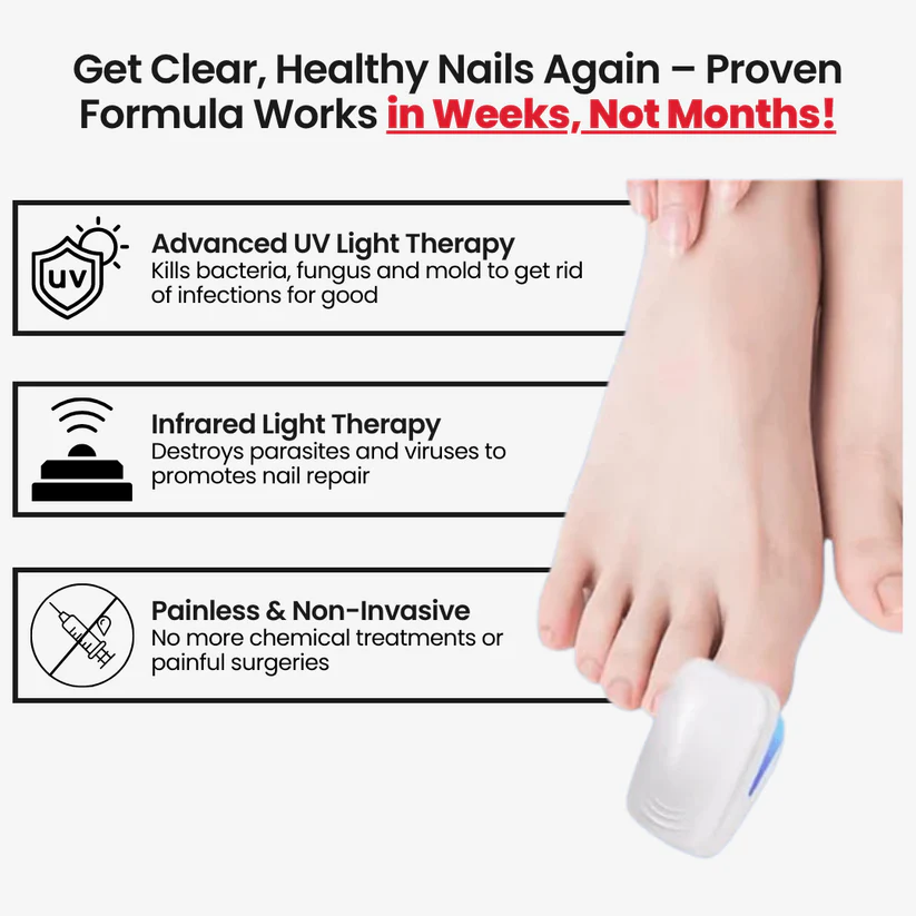 Laser Nail Fungus Treatment Device – Deep Penetration & Fast Repair