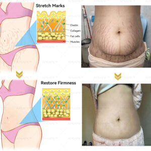 anti aging honey cream for smooth skin