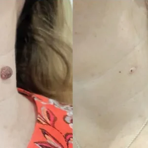 black rice skincare cream