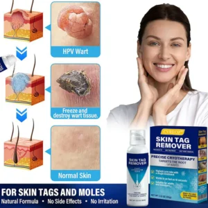 gentle cryo skin support product