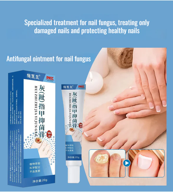 Anti-Fungal Nail Repair Cream – Clear, Healthy & Strong Nails Formula