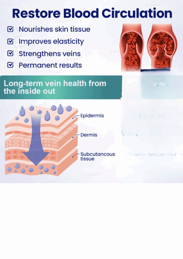 Herbal Varicose Vein Relief & Leg Comfort Cream