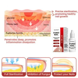 fungus affected nail care
