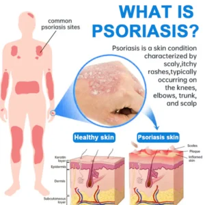 kubozn magnesium herbal spray