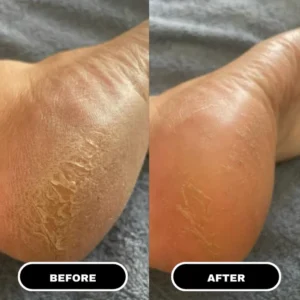 everyday foot care tool