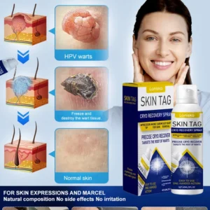 laniska skin care topical spray