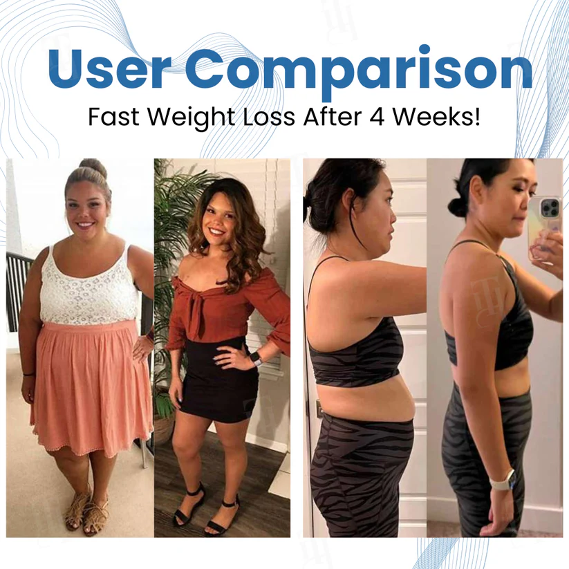 AEXZR® Clinical Body Sculpting System - Image 2