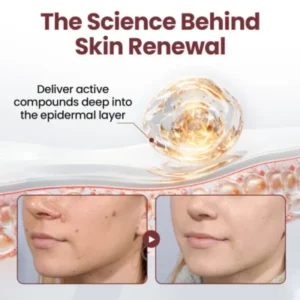 cosmetic skin renewal cream