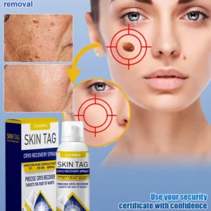 skin care topical spray