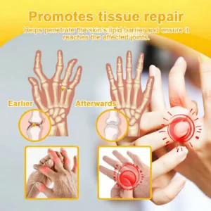 virexo body comfort care cream