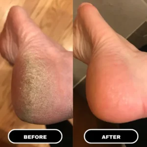 foot care stick