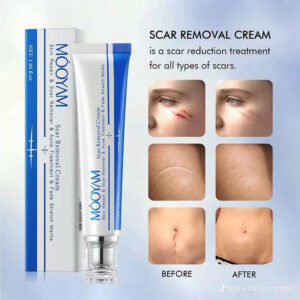 cosmetic scar care product