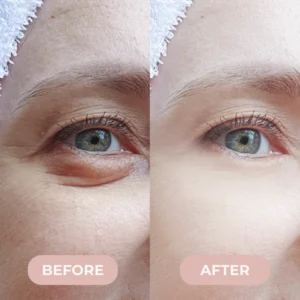 eye care skincare patches