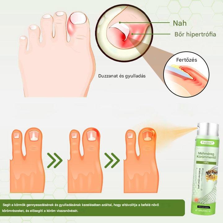 bee venom nail care spray