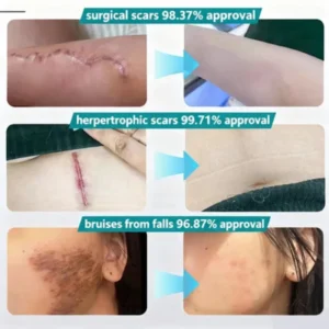 cosmetic moisturizing cream