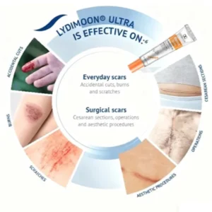 lydmoon skin care cream