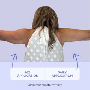 vitalglow botanical arm toning formula