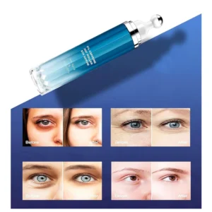best eye serum for smoothing under-eye wrinkles