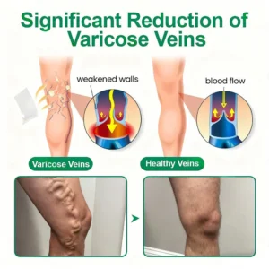 healrize microneedle technology for leg circulation