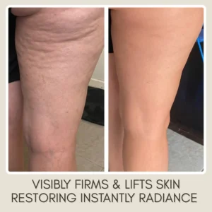 velen body oil before and after deep hydration