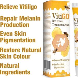 vitigo bee venom cream before and after white spots