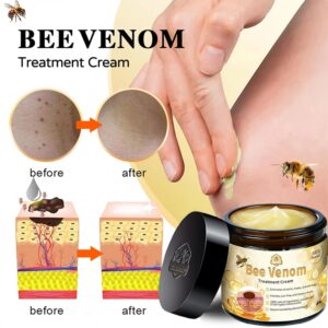 gentle bee venom cream for skin imperfections bswell