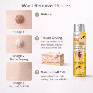 md advance professional strength wart formula