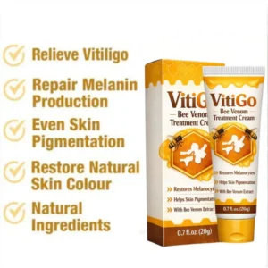 md vitigo advanced cream for even complexion