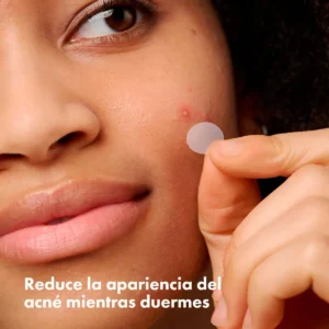 mighty patch results for shrinking stubborn acne