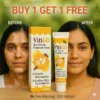 vitigo corrector for skin white spots