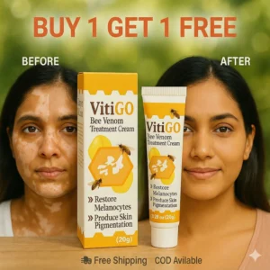 vitigo corrector for skin white spots