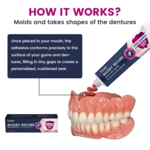 dental prosthesis bonding for dentures