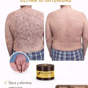 bee venom skin rejuvenation cream