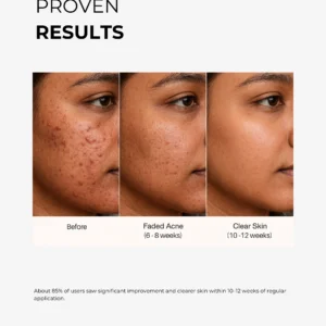niacinamide serum before and after skin texture improvement