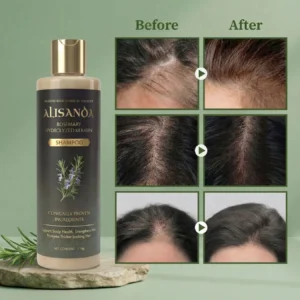 alisanda® rosemary shampoo