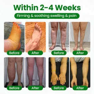 how to use laozik venosoothe spray for leg comfort