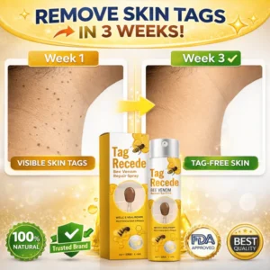 md advance spray for common and plantar warts