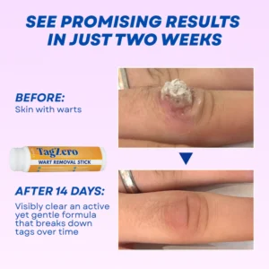 natural precision formula by timilk brand