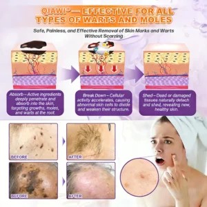 qiawi cream before and after skin restoration