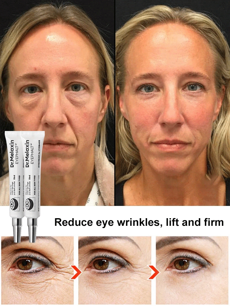 anti-wrinkle essence eye cream for results