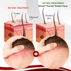 advanced skin repair formula by anniecare brand