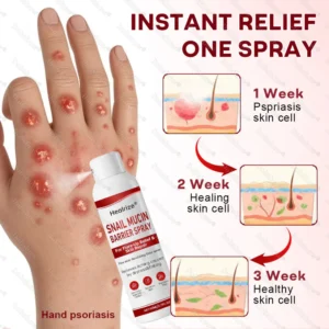 soothing eczema and irritation with healrize snail spray