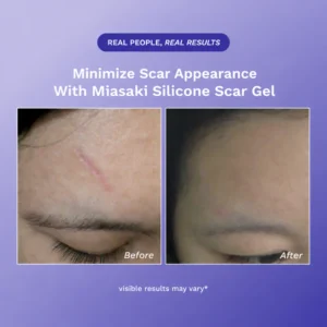 advanced silicone technology by miasaki brand