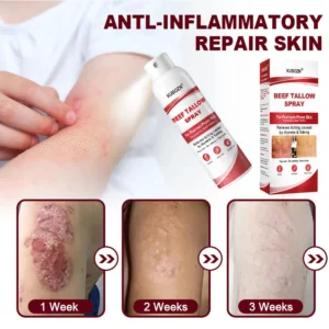 best spray for boosting natural skin barrier