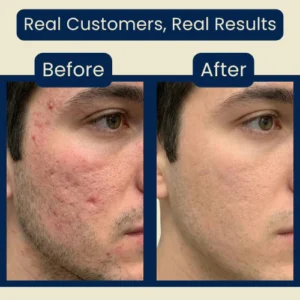 nolvana serum before and after collagen boost