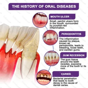 dobshow toothpaste before and after teeth whitening
