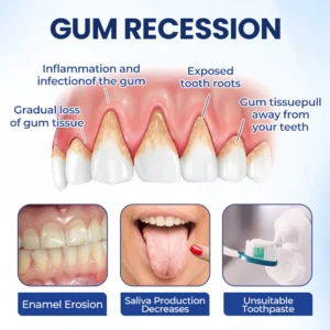 natural bee venom formula for teeth by biancat brand