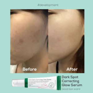 axis-y professional grade dark spot serum reviews