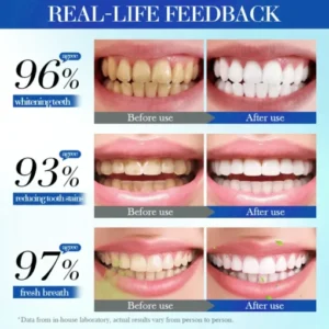 soothing tooth sensitivity with alisanda fluoride-free formula