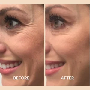 advanced acid exfoliation technology by skincare brand